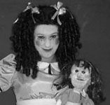 Freakshow conjoined twin